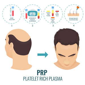 PRP THERAPY