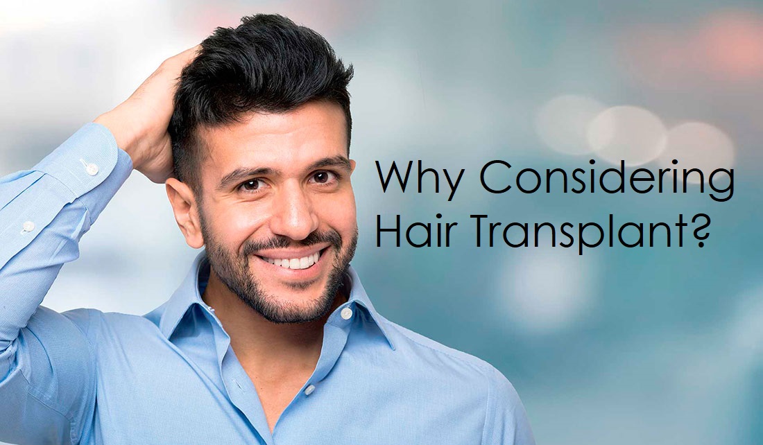 why considering hair transplant