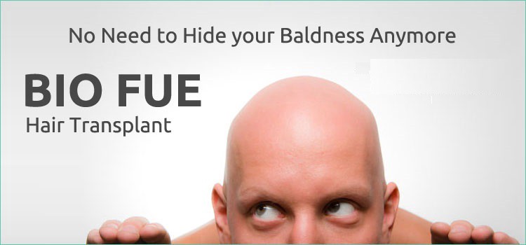 bio fue hair transplant