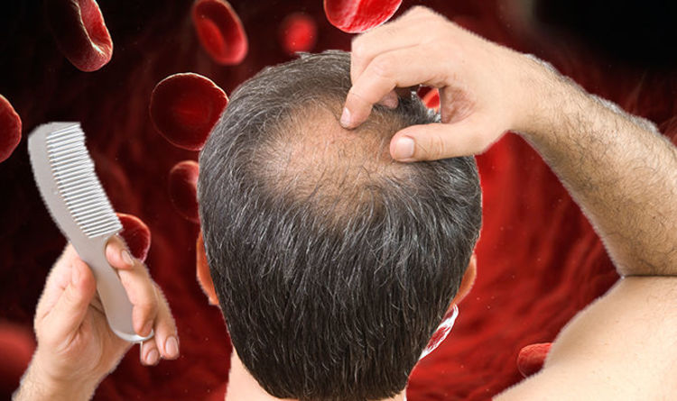 Hair loss causes Anaemia