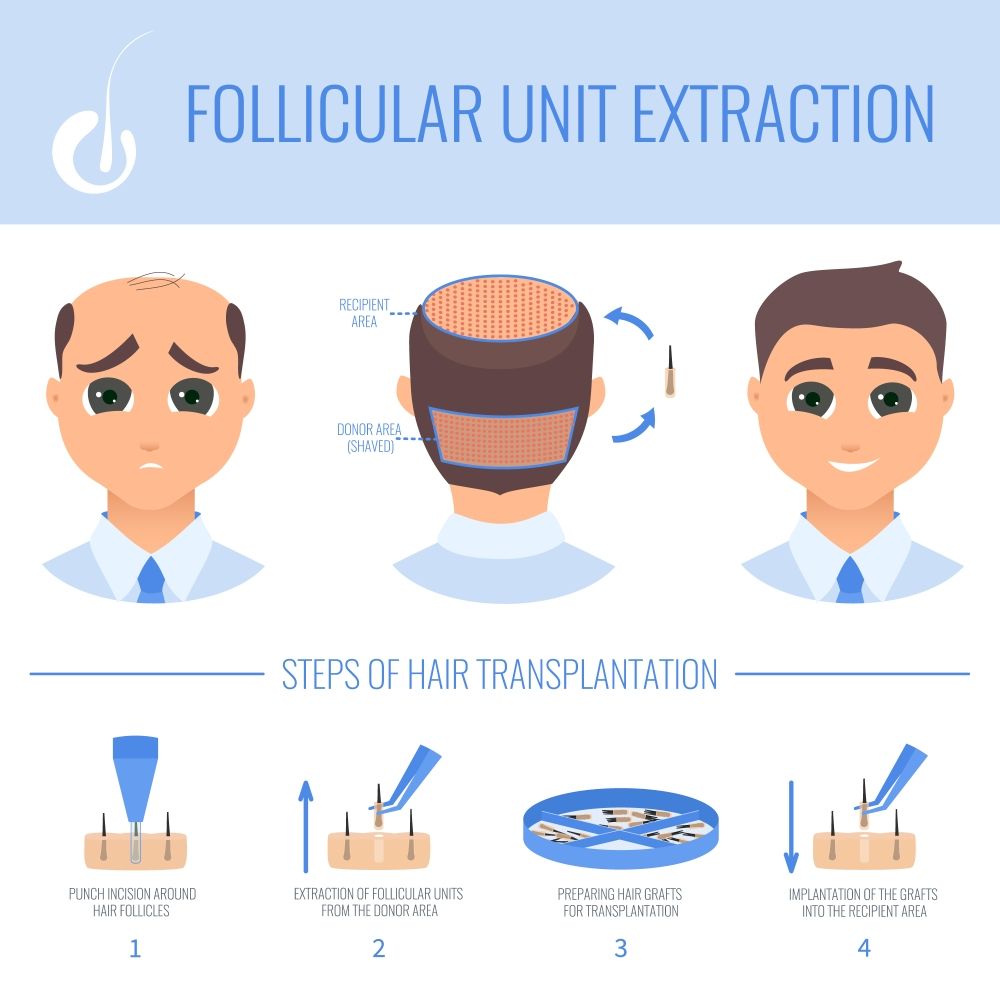 fue hair transplant