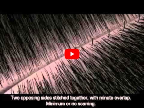 First Choice Hair Transplant & Cosmetics