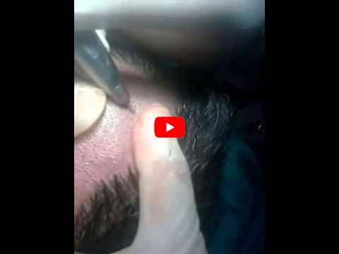 First Choice Hair Transplant & Cosmetics