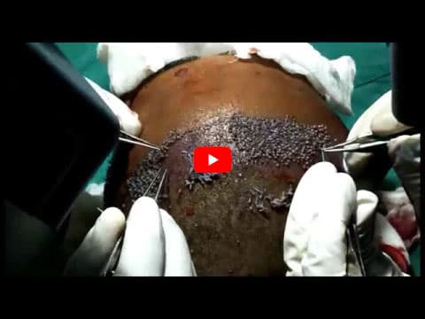 First Choice Hair Transplant & Cosmetics