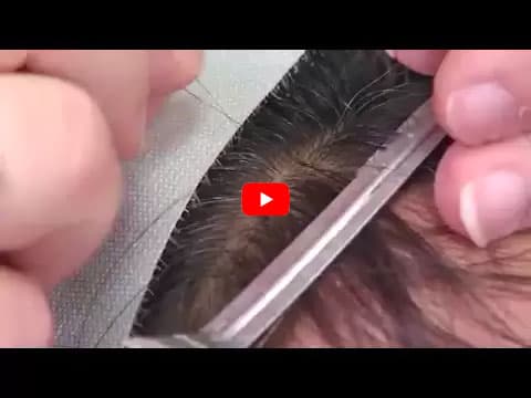 First Choice Hair Transplant & Cosmetics