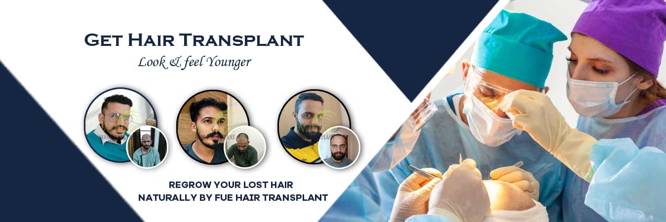 Hair Transplant in India