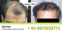 Dr Kavish Chouhan - Hair Transplant Surgeon in Green Park, Janakpuri, Delhi